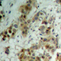 - Anti-AKT (pT450) Antibody AP60532